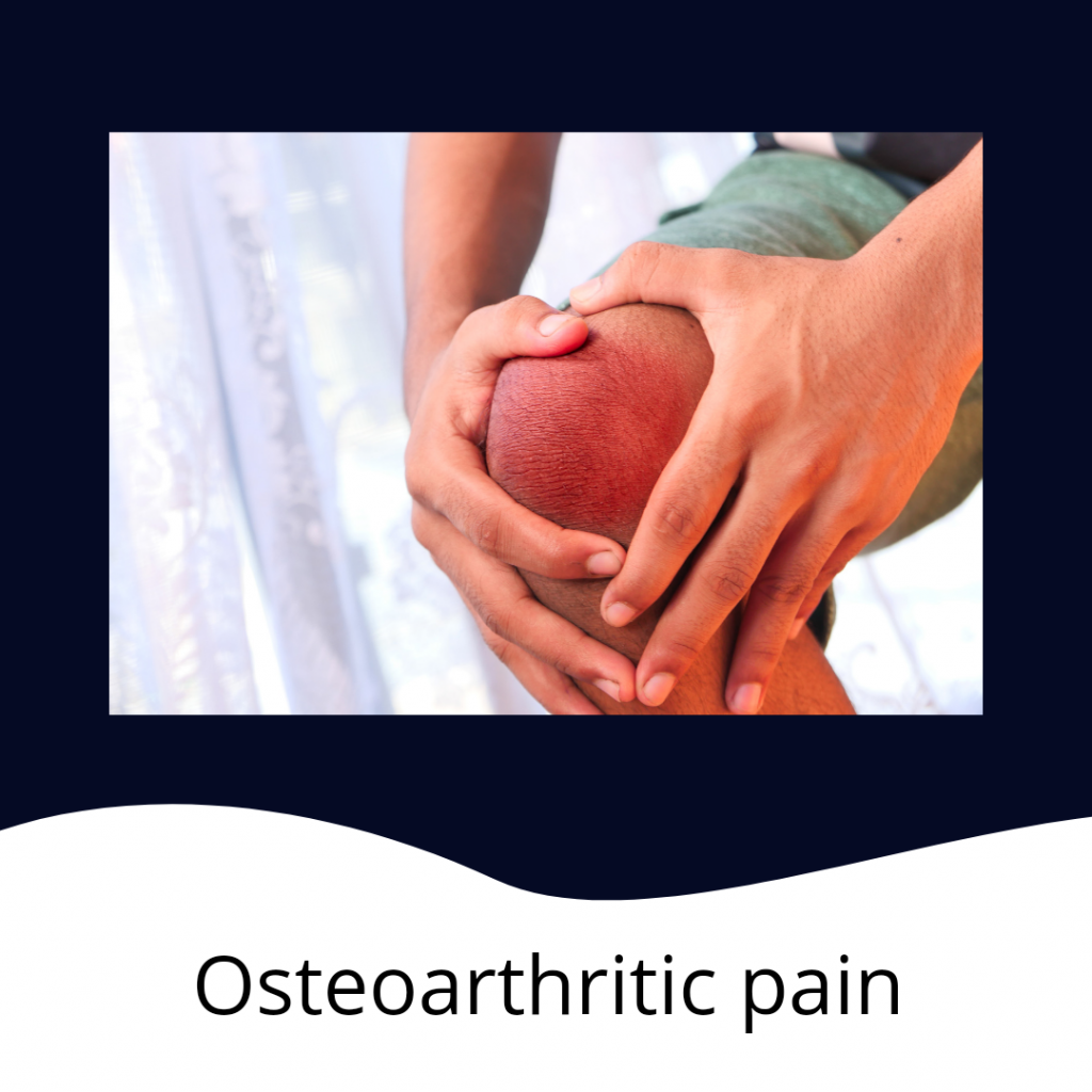 Drug Therapy In Osteoarthritis PHYSIOSPARKS